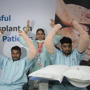 Hand transplant patients SQUARE
